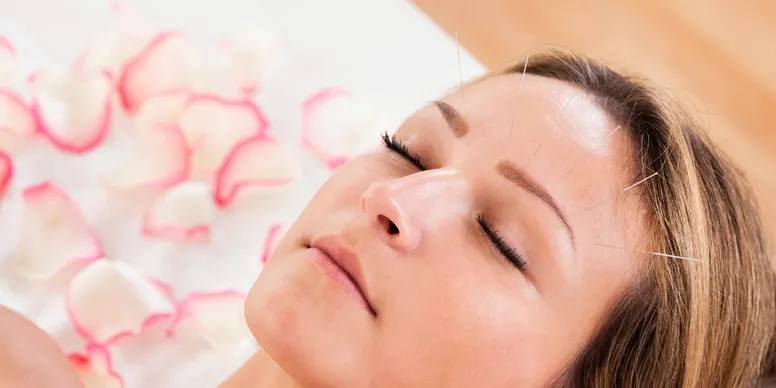 cosmetic acupuncture